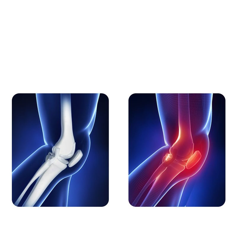 Rechargeable EMS Knee Therapy Device with Gentle Heat and Massage