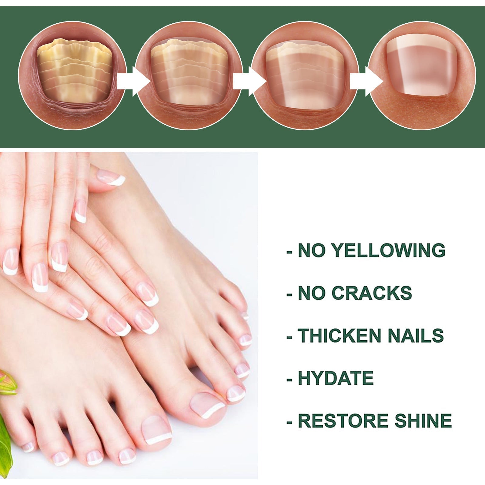 Nail repair solution bottle for healthy-looking nails