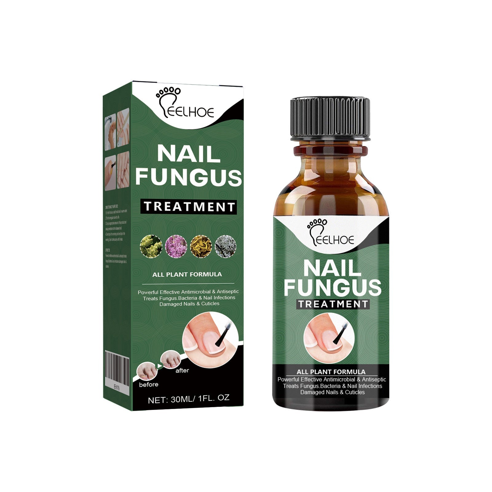 Nail strengthening solution for damaged toenails