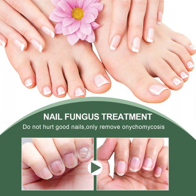 Foot care liquid treatment for toenail maintenance